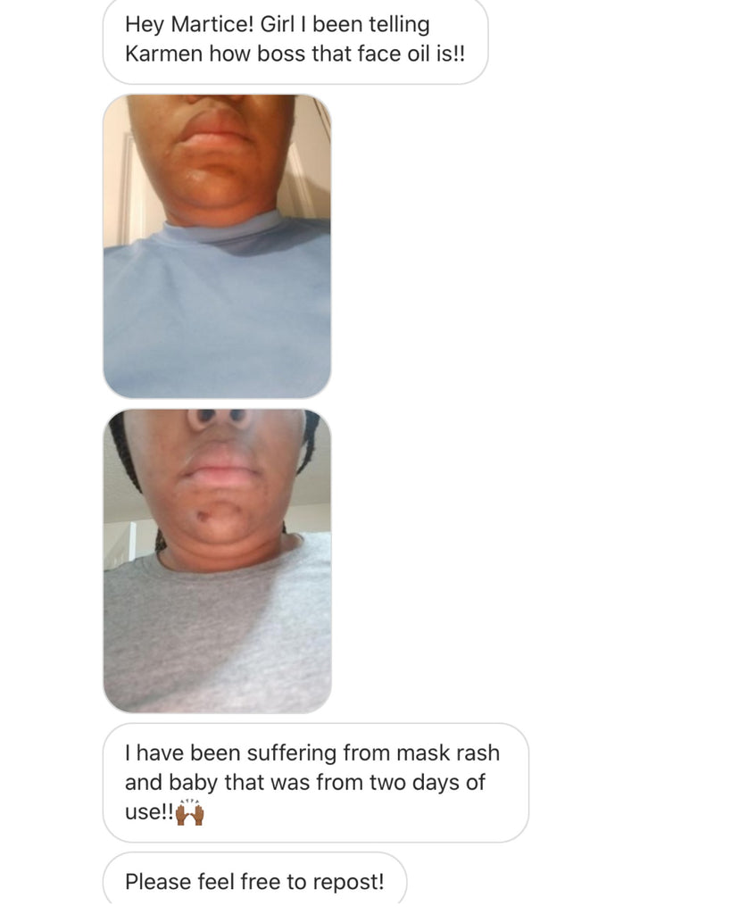 MHO Skin Oil